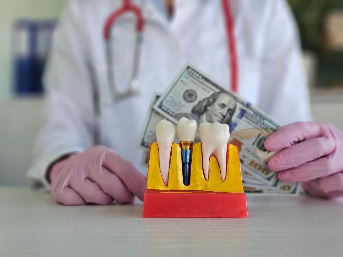 Dental implant costs in Sarasota